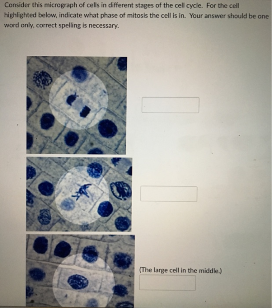 Consider this micrograph of cells in different stages of the cell cycle. For the cell highlighted below, indicate what phase