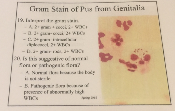 Gram Stain of Pus from Genitalia 19. Interpret the gram stain. - A. 2+ gram+cocci, 2+ WBCs - B. 2+ gram- cocci, 2+ WBCs - C.
