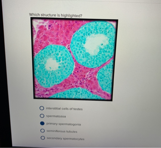 Which structure is highlighted? O interstitial cells of testes O spermatozoa primary spermatogonia O seminiferous tubules O s