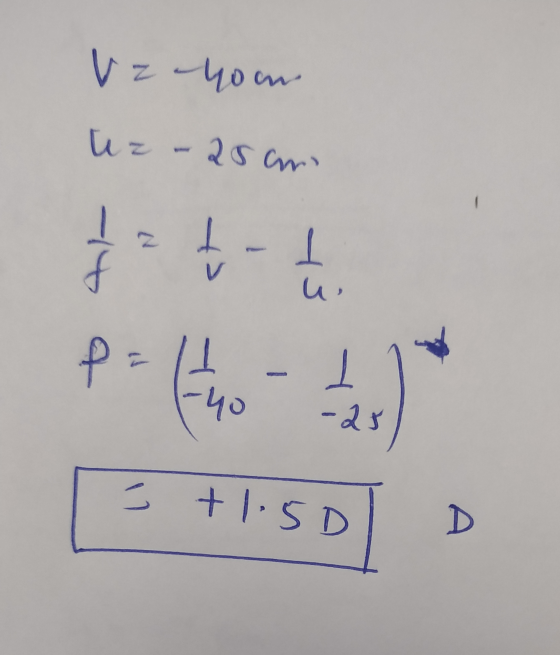 V z-you uz - 25cm - 2 AI 1 V u P = ( 4 1-40 -28 - +1.5D D