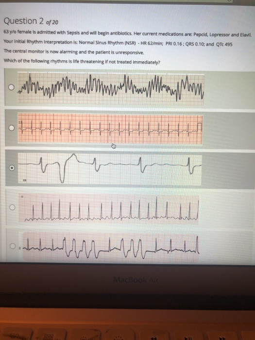 Question 2 of 20 63 y/o female is admitted with Sepsis and will begin antibiotics. Her current medications are: Pepcid, Lopre
