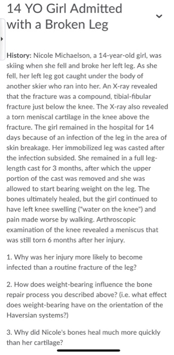 14 YO Girl Admitted with a Broken Leg History: Nicole Michaelson, a 14-year-old girl, was skiing when she fell and broke her