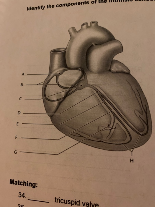 Identify the components of the InlIISIU Matching: tricuspid valve