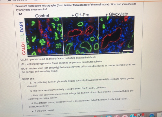 Below are fluorescent micrographs (from indirect fluorescence of the renal tubule). What can you conclude by analyzing these