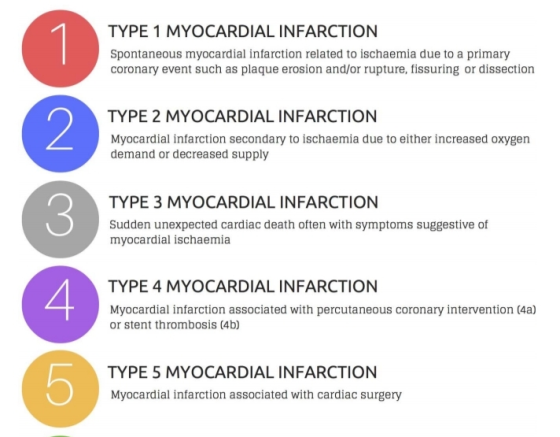 TYPE 1 MYOCARDIAL INFARCTION Spontaneous myocardial infarction related to ischaemia due to a primary coronary event such as p