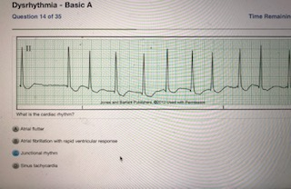 Dysrhythmia- Basic A Question 14 of 35 Time Remainin II wht s cande y A on with rd oular eponen aunconal nythe Srua lachada