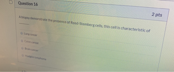 Question 16 2 pts A biopsy demonstrate the presence of Reed-Stemberg cells, this cell is characteristic of Lung cancer Colon