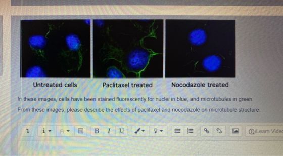 Untreated cells Paclitaxel treated Nocodazole treated In these images, cells have been stained fluorescently for nuclei in bl