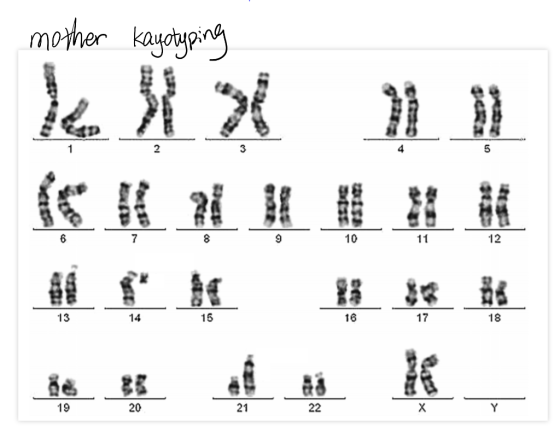 mother kayotyping X 主打 2 3 5 基 6 7 6 9 10 11 12 13 14 15 23 5 6 5. 现在 3 22 X Y