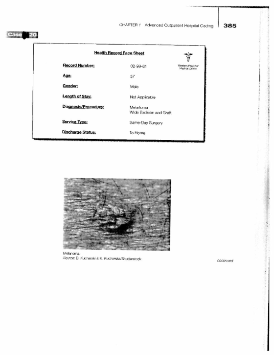 CHAPTER 7 Advanced Outpatient Hospital Coding! 385 Case 20 Health Record. Face Sheet Record Number; Vestern. 02-99-81 Age: Ge