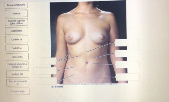 Linea semilunaris Areola Anterior superior spine of ilium Acromion Umbilicus Deltoid m Linea alba External abdominal obliquem