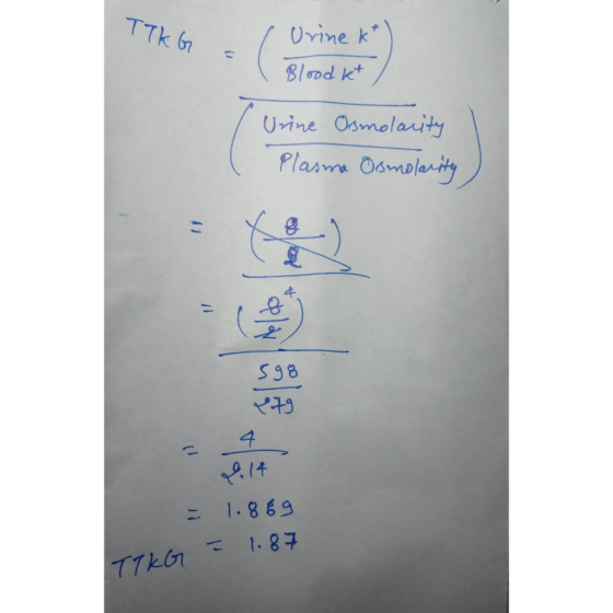 TTKG = Urine kt) Blood kt ( Urine Osmolarity Plasma Osmolarity - 4 V 14 1.869 TT KG = 1.87