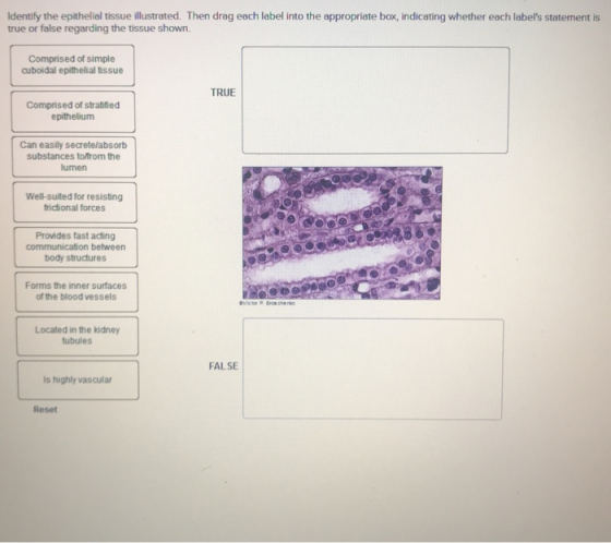 Identify the epithelial tissue illustrated. Then drag each label into the appropriate box, indicating whether each labels st