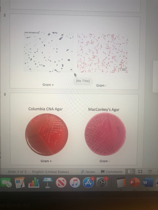 N (No Title) Gram + Gram - 3 Columbia CNA Agar MacConkeys Agar Gram + Gram - 0 Slide 2 of 3 English (United States) Notes Co