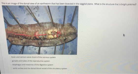 This is an image of the dorsal view of an earthworm that has been bisected in the saggital plane. What is the structure that