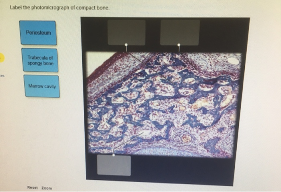 Label the photomicrograph of compact bone. Periosteum Trabecula of spongy bone Marrow cavity Reset Zoom