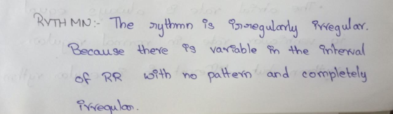 BYTH MN The nuthmn is meglaryegular Because there Ps varable the ntewal paten and completely w9th no of RR Frequlan