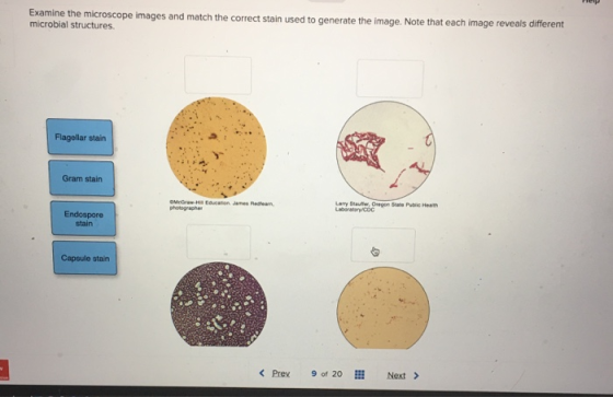 Examine the microscope images and match the correct stain used to generate the image. Note that each image reveals different