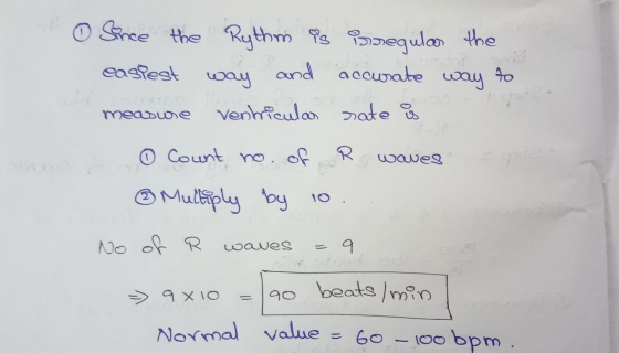 OSree the Reythm egula the easfest oay and aocusate au 0 Venhfeula ate meabue O Count no. o R wawes Muliply foy 10 No of R av