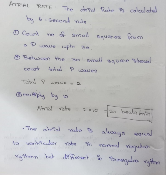 ATRIAL RATE The ara Rate alculate 6 Second ule by O Count 3mall Squaes from no upto 30 Poawe a Between the smal squane nteual