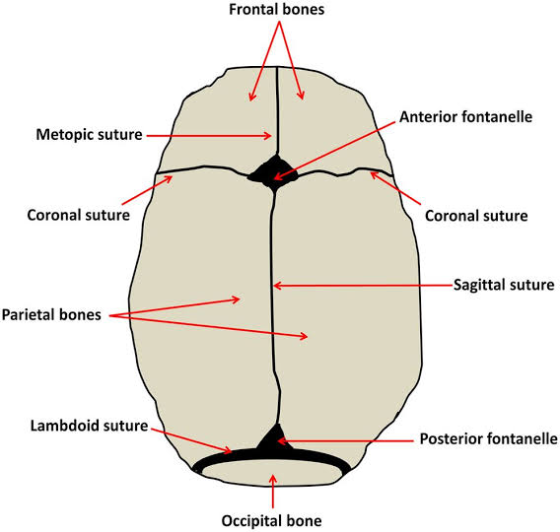 Frontal bones Anterior fontanelle Metopic suture Coronal suture Coronal suture -Sagittal suture Parietal bones Lambdoid sutur