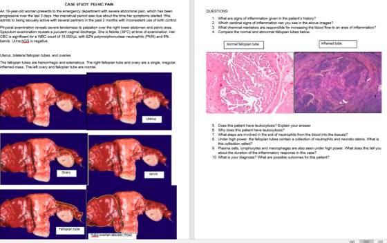 CASE STUDY: PELVIC PAIN An 18-year-old woman presents to the emergency department with severe abdominal pain, which has been
