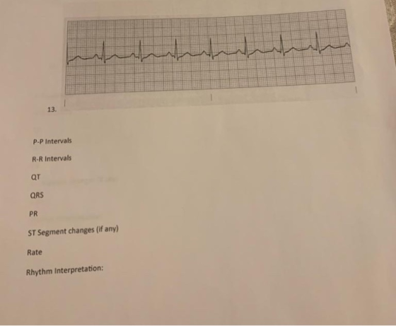 لراباماماماب ا 13. P-P Intervals R-R Intervals QT QRS PR ST Segment changes (if any) Rate Rhythm Interpretation: