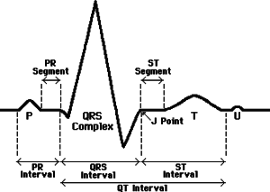 qt-interval-300x213.png