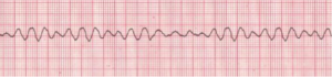 sal-42-acls-300x70.png