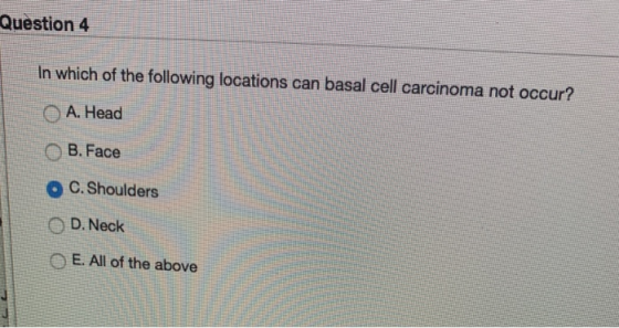 Question 4 In which of the following locations can basal cell carcinoma not occur? A. Head B. Face C. Shoulders D. Neck E. Al