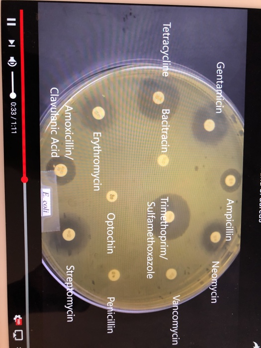 Ampicillin Gentamicin Neomycin Vancomycin Tetracycline Bacitracin Trimethoprim/ Sulfamethoxazole Optochin Penicillin Erythrom