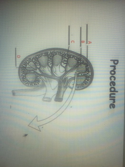 Procedure C D