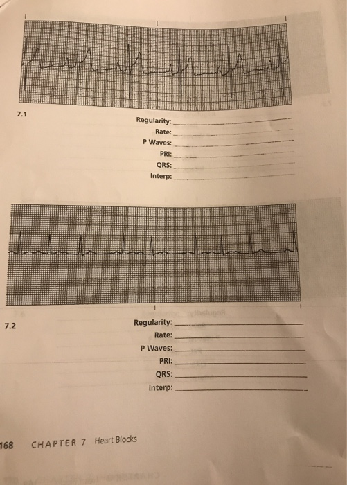 Regularity: Rate: P Waves: PRI: QRS: Interp: 7.2 Regularity: Rate: P Waves: PRI: QRS: Interp: 768 CHAPTER 7 Heart Blocks
