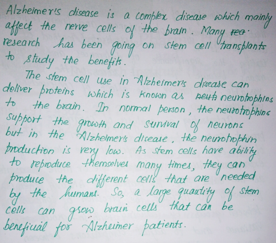 Alzheimers dlisease is a combler disease swhich mainly ect the nerve cells of the brain. Many rea resea rch ha, been going o