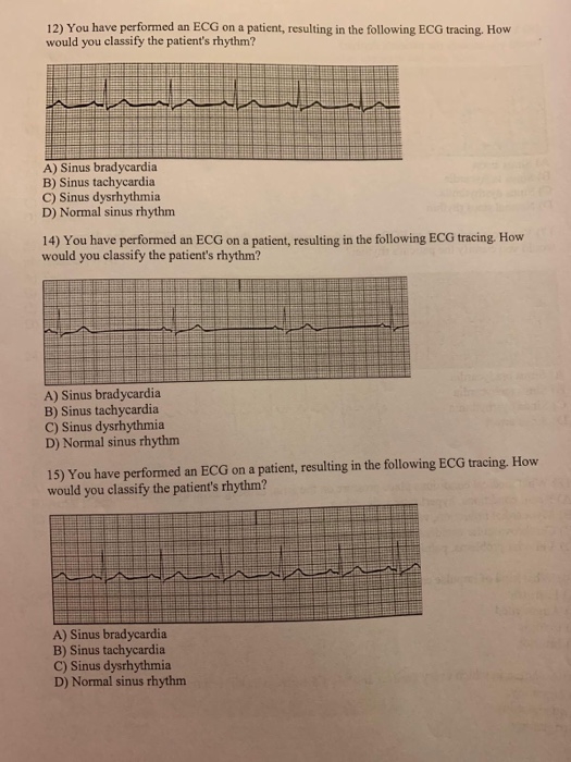 12) You have performed an ECG on a patient, resulting in the following ECG tracing. How would you classify the patients rhyt