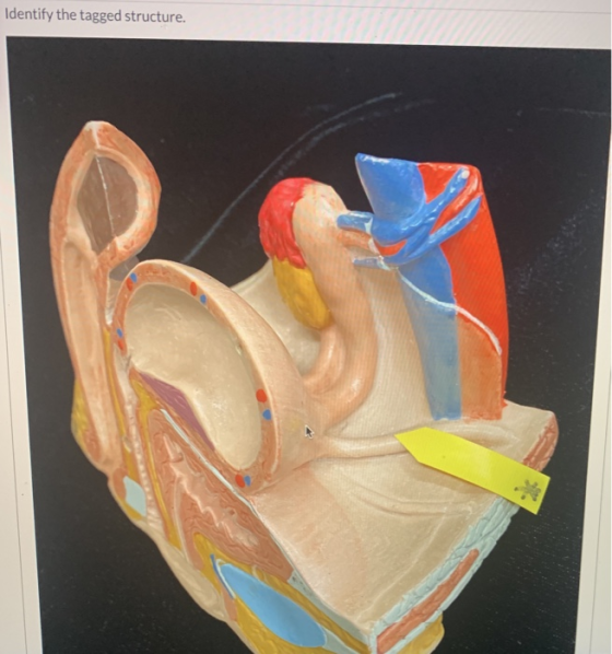 Identify the tagged structure.