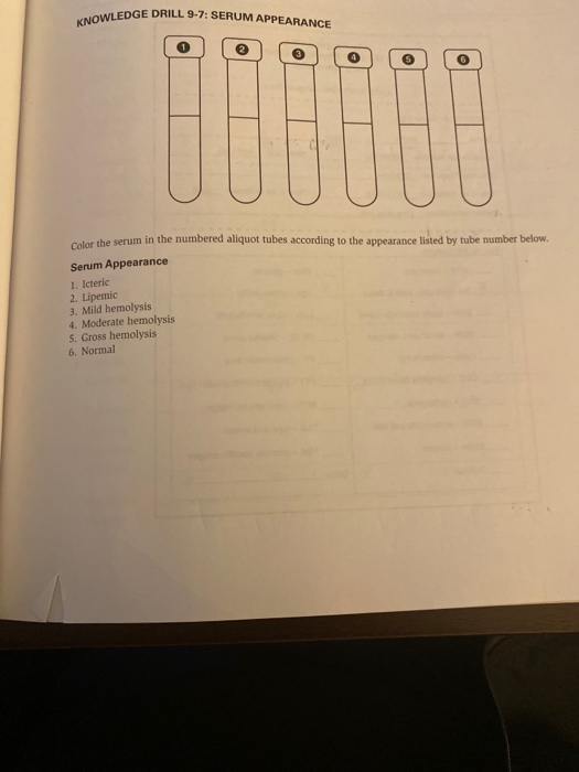 OWLEDGE DRILL 9-7: SERUM APPEARANCE Color the serum in the numbered aliquot tubes according to the appearance listed by tube