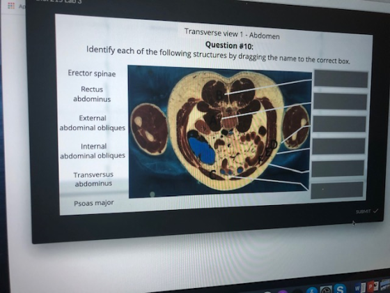 Transverse view 1 - Abdomen Question #10: Identify each of the following structures by dragging the name to the correct box.