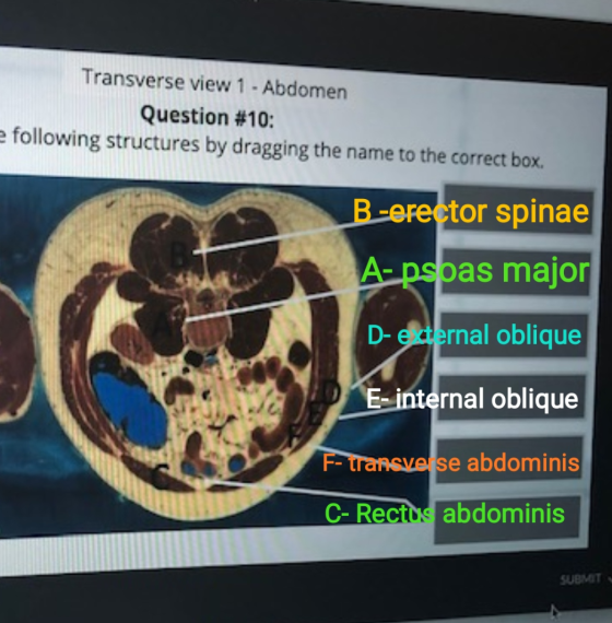Transverse view 1 - Abdomen Question #10: e following structures by dragging the name to the correct box. B-erector spinae A-