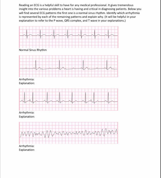 Reading an ECG is a helpful skill to have for any medical professional. It gives tremendous insight into the various problems