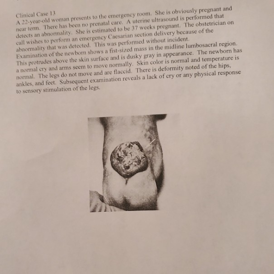 Clinical Case 13 A 22-year-old woman presents to the emergency room. She is obviously pregnant and near term. There has been