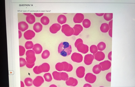QUESTION 14 What type of Leukocyte is seen here?