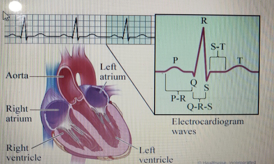 Left atrium Aorta Right atrium P-R Q-R-S Electrocardiogram waves Right ventricle Left ventricle