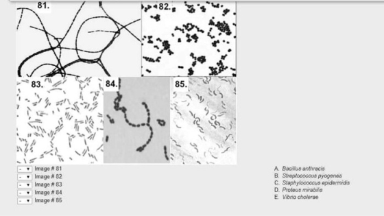 81. 82. 83. 84. 85. འདས་ Image #81 Image # 82 Image #83 Image # 84 Image #85 A. Bacillus anthracis B. Streptococcus pyogenes