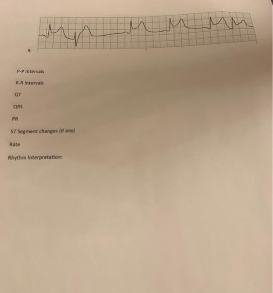 P-P Intervals R-R Intervals QT QRS PR ST Segment changes (if any) Rate Rhythm Interpretation: