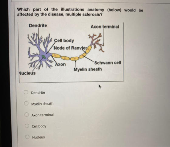 Which part of the illustrations anatomy (below) would be affected by the disease, multiple sclerosis? Dendrite Axon terminal