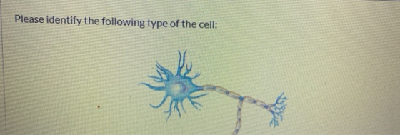 Please identify the following type of the cell: