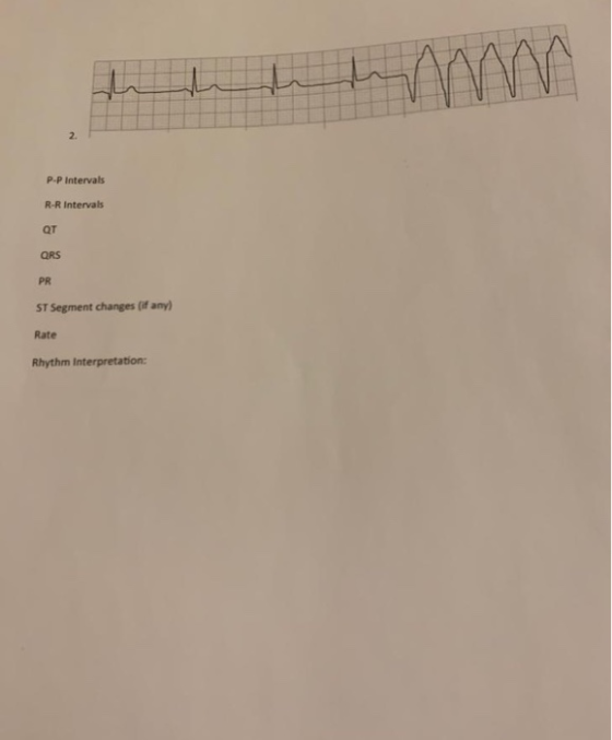 tehti P-P Intervals R-R Intervals QT QRS PR ST Segment changes (if any) Rate Rhythm Interpretation: