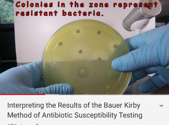 Colonies in the zone represent resistant bacteria. Interpreting the Results of the Bauer Kirby Method of Antibiotic Susceptib