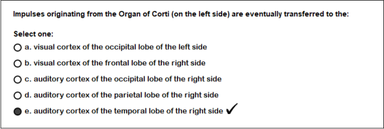 Impulses originating from the Organ of Corti (on the left side) are eventually transferred to the: Select one: a. visual cort